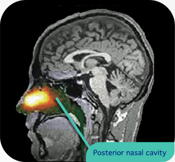 Breath Powered® delivery of lactose powder