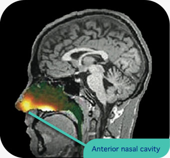 Nasal spray delivery of saline solution